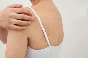 Is TPU clear elastic tape harmful to skin?